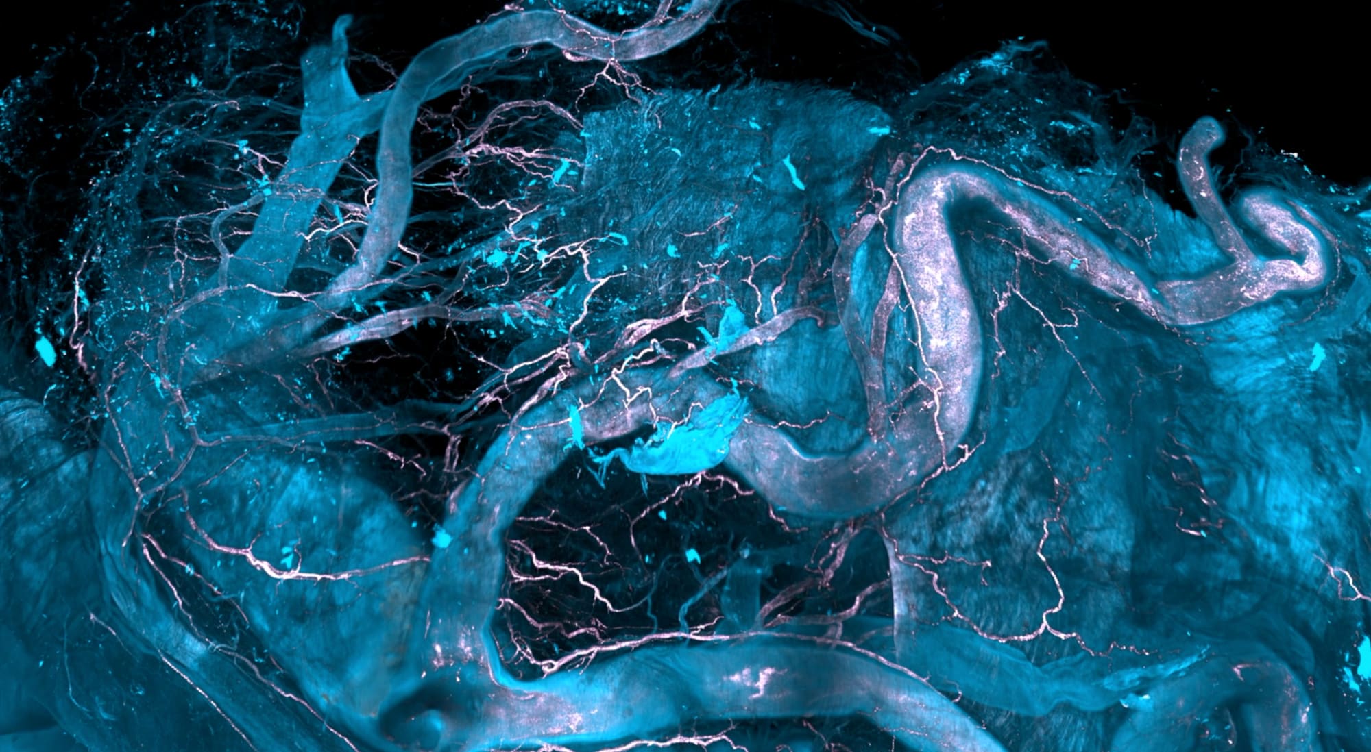 Das Bild zeigt die Aortenregionen eines menschlichen Herzens, dessen vaskuläre Plaques mit der DISCO-MS-Technologie analysiert wurden