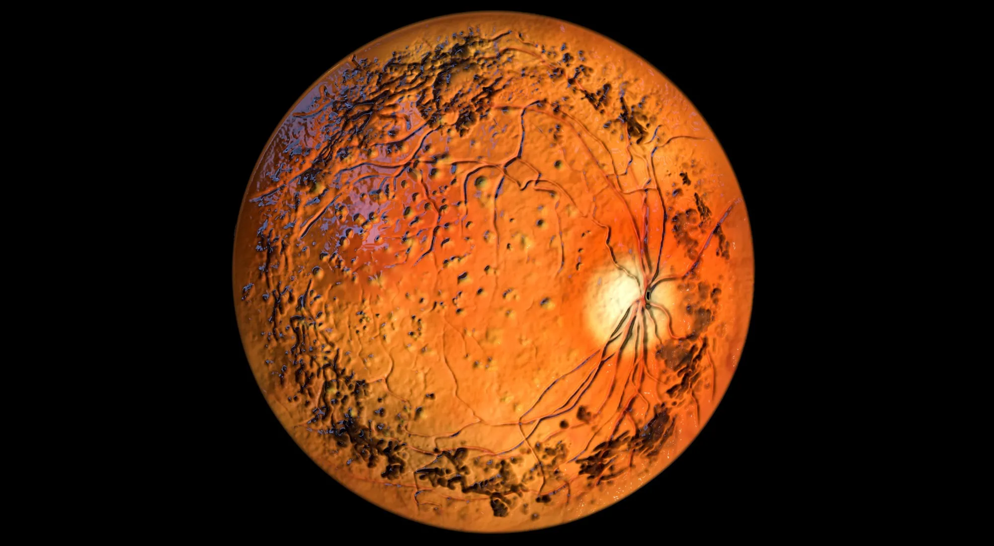 3D-Darstellung der Netzhaut eines Auges